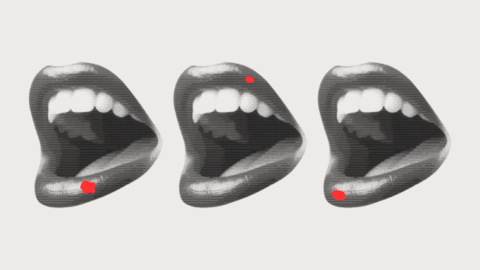 canker sore