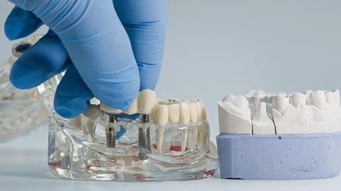 model of teeth