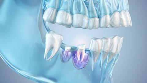 3D illustration of regenerative dental treatment showing tooth roots, surrounding bone, and oral tissues.