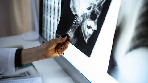 doctor holding xray of skull