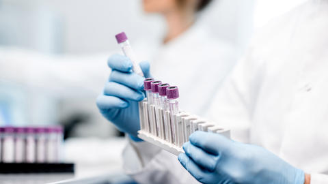 Person wearing blue gloves holding set of test tubes