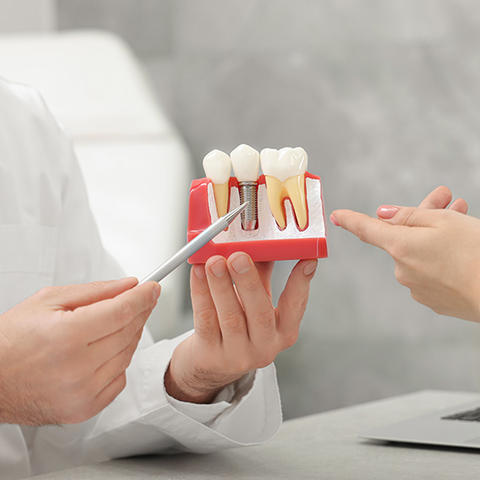 clsoe up of a dentist holding a model of teeth using pen to point to implant to a patient seated opposite him. 