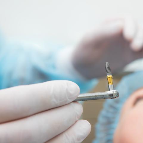 dentist holding an implant