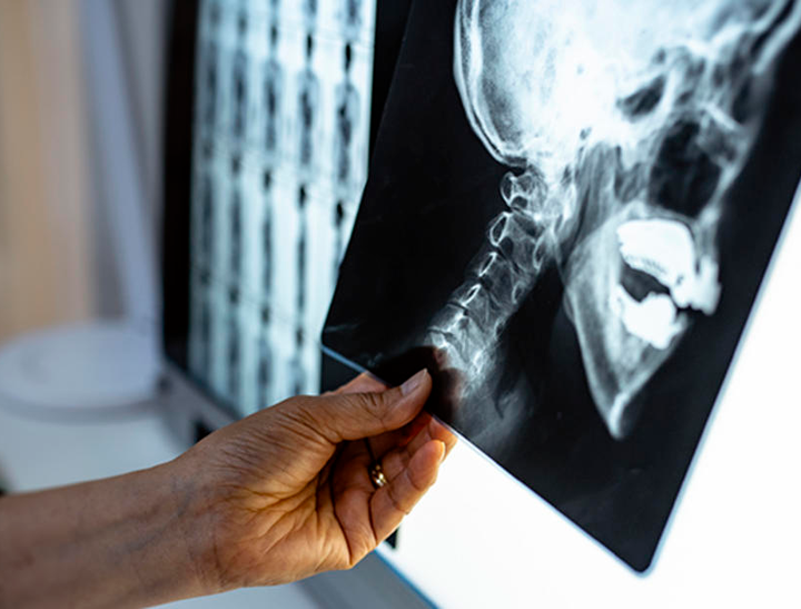 X-ray of a human skull