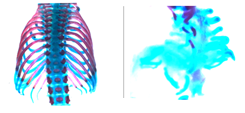alcian blue (cartilage) and alizarin red (bone) stained embryonic skeletons of the mouse trunk cleared of soft tissues