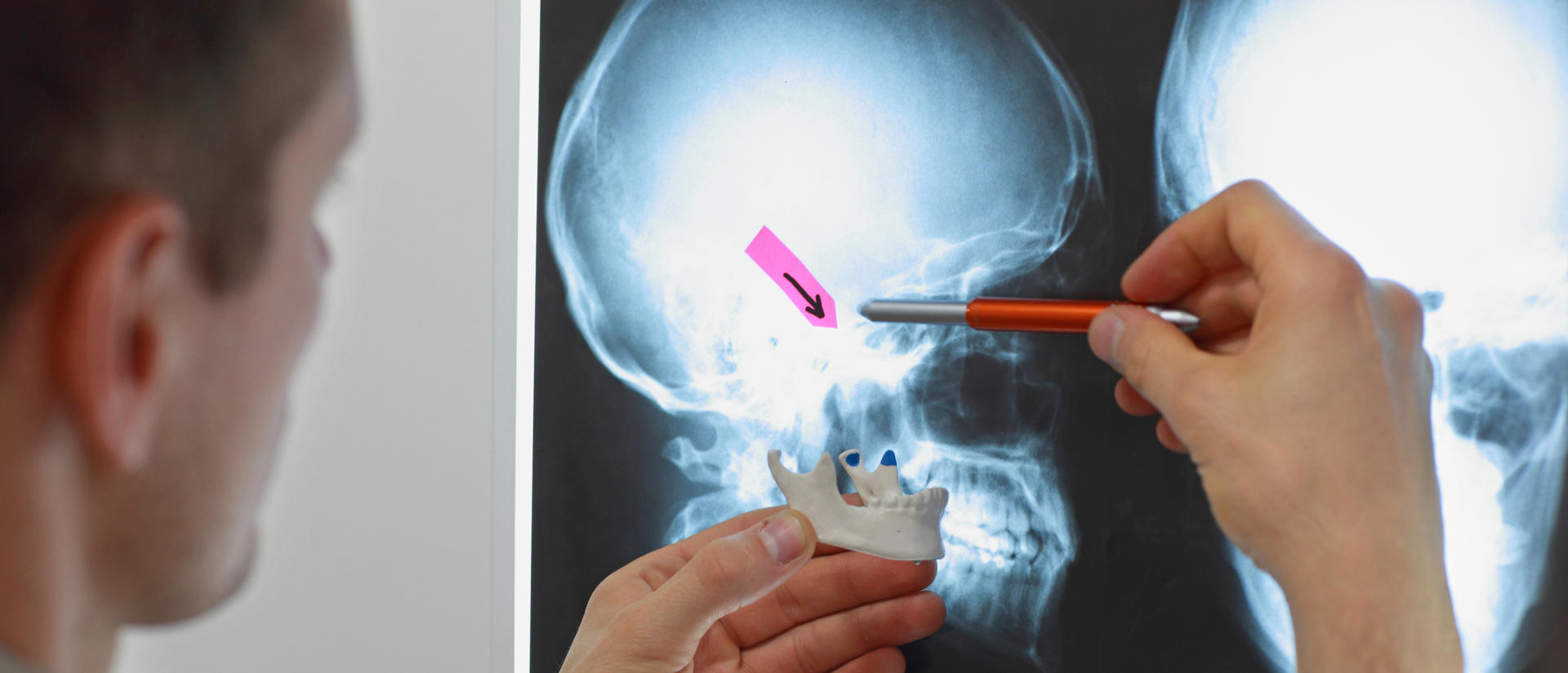 researcher viewing a head x-ray