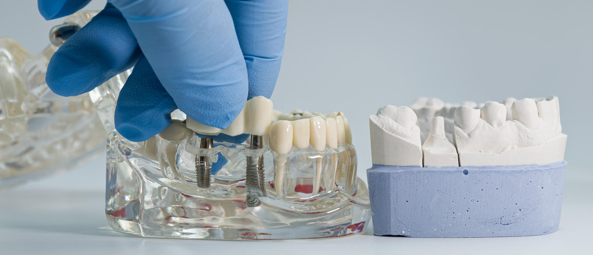 model of teeth