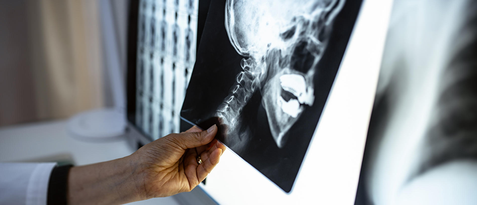 doctor holding xray of skull