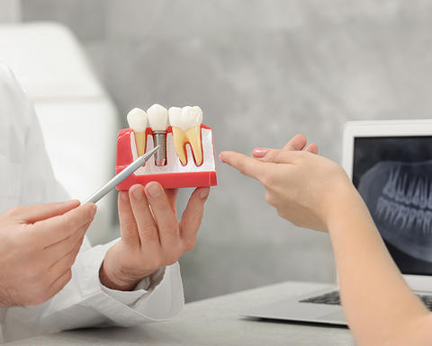 clsoe up of a dentist holding a model of teeth using pen to point to implant to a patient seated opposite him. 