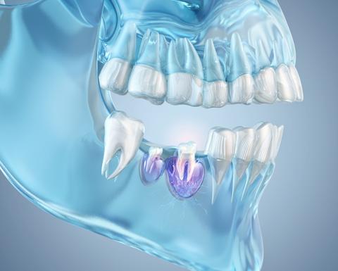 3D illustration of regenerative dental treatment showing tooth roots, surrounding bone, and oral tissues.